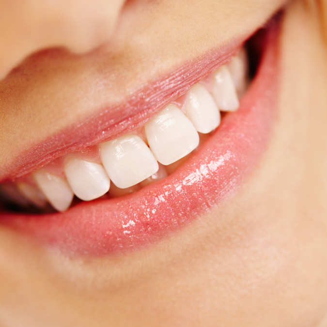 Odontologia estética