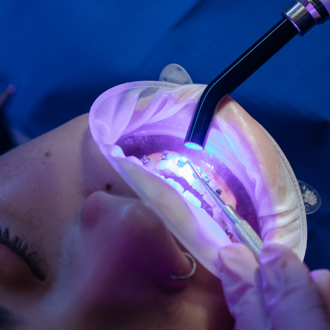 Dentística