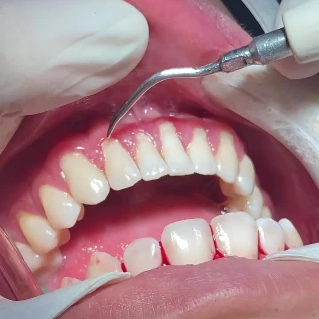 periodontia